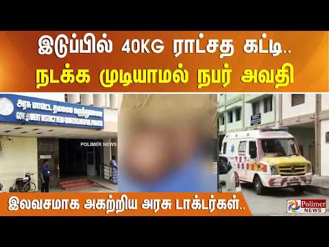 இடுப்பில் 40KG ராட்சத கட்டி.. நடக்க முடியாமல் நபர் அவதி -  இலவசமாக அகற்றிய அரசு டாக்டர்கள்.. thumbnail