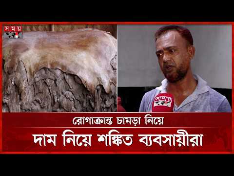 আড়তে আসা ৩৫ ভাগ পশুর চামড়া রোগাক্রান্ত, দাম নিয়ে শঙ্কায় ব্যবসায়ীরা | Kushtia Leather | Somoy TV thumbnail