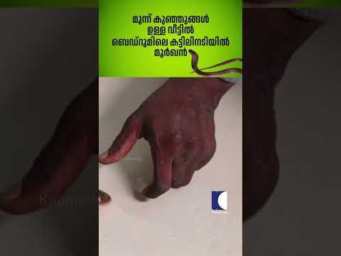മൂന്ന് കുഞ്ഞുങ്ങൾ ഉള്ള വീട്ടിൽ ബെഡ്‌റൂമിലെ കട്ടിലിനടിയിൽ മൂർഖൻ #snakemaster #vavasuresh #cobra thumbnail