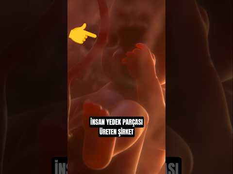 İnsan yedek parçası üreten şirket #shortvideo thumbnail