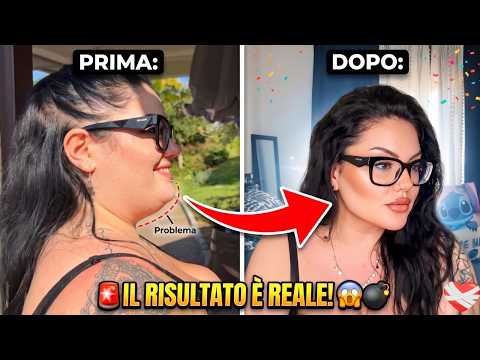 ADDIO DOPPIO MENTO ?!😱 TEST SHOCK DI UN PRODOTTO VIRALE |chiara paradisi thumbnail