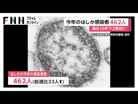 はしか感染者数462人　直近10年間で最多の2019年に迫る勢い　推定される感染場所「国内」が7割（2026年05月14日） thumbnail