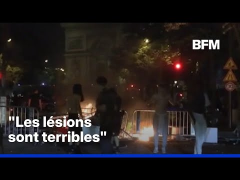 Violences à Paris: la procureure annonce que "des policiers ont été atteints par une bombe agricole" thumbnail