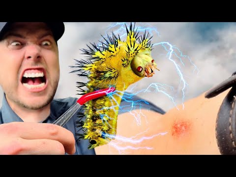 STUNG by an Electric Caterpillar! thumbnail