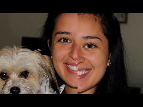 Texas Nurse Becomes The Patient After Having A Stroke At 24 thumbnail