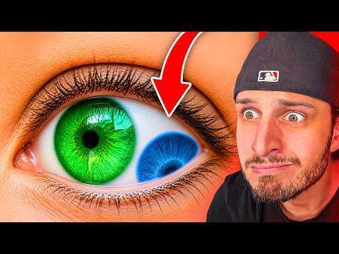 0,0001% de Chance d'Avoir cette Particularités Physiques ! thumbnail