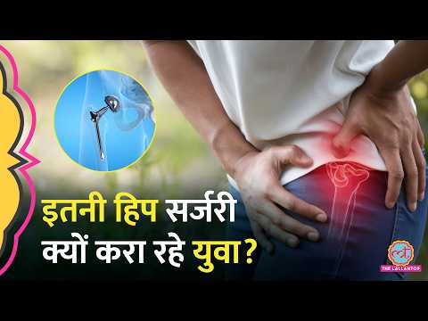 Hip Replacement Surgery के मामले Youth  में Covid बाद इतना क्यों बढ़ गए?| Avascular Necrosis thumbnail
