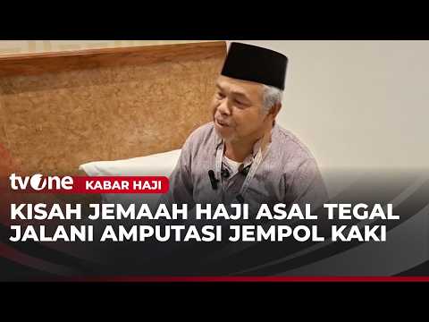 Jemaah Haji Asal Tegal Jalani Amputasi usai Alami Pembengkakan | Kabar Haji thumbnail