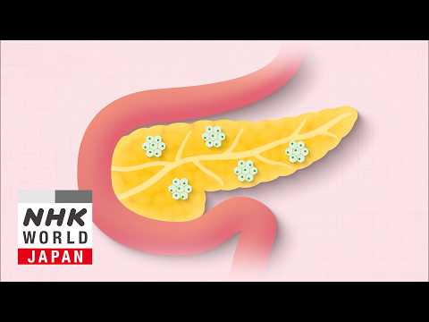 GLP-1 Drugs for Obesity: Benefits and Risks - Medical Frontiers thumbnail