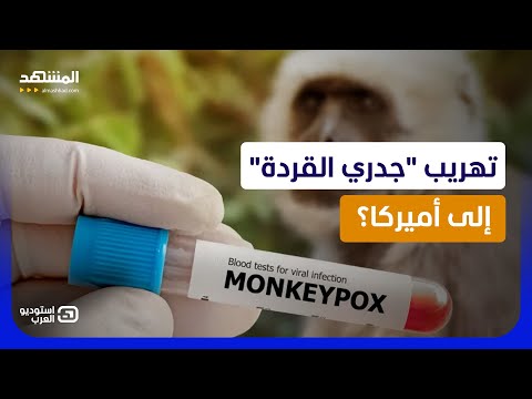 تهريب فيروس جدري القردة إلى الولايات المتحدة.. وصدمة في غرفة التحقيق! - استوديو العرب thumbnail