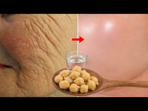 Look younger even at 70 thanks to this anti-wrinkle lifting remedy. thumbnail