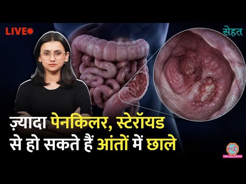 पेट में सूजन, दस्त, खून? हो सकती है ये गंभीर बीमारी! Gut Health Warning Signs | Sehat thumbnail