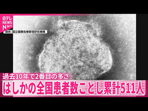 【累計511人】はしかの全国患者数  過去10年で2番目の多さに thumbnail