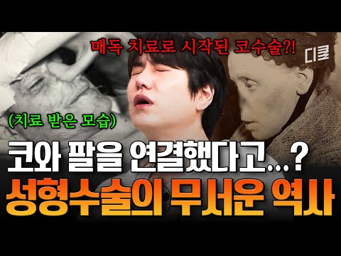코가 괴사됐는데 팔을 이어 붙인다고?😨 성형수술을 발전시킨 기상천외한 수술법 #벌거벗은세계사 thumbnail