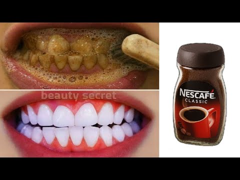 The recipe that dentists are hiding from us🔥!It whitens teeth and eliminates tartar in 1 minutes. thumbnail