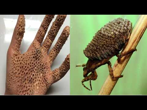 30 Insectos más Peligrosos del Mundo thumbnail