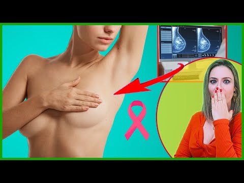🟢MILAGRE: COMO ME CUREI DE 2 CÂNCERES MALÍGNOS em 4 MESES 🎗️🙏 thumbnail
