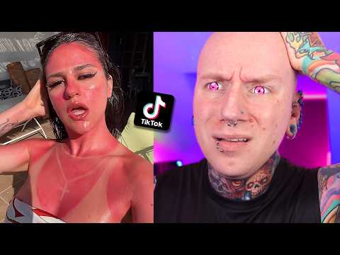Sunburn Is Apparently Trendy Now... thumbnail