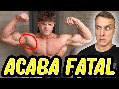 Los esteroides lo están dejando mal de la cabeza *culturista open de 21 años* thumbnail