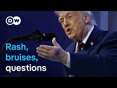 Trump says he's healthy amid new questions over recent images | DW News thumbnail