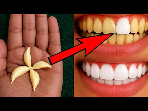 The recipe that dentists are hiding from us🔥!It whitens teeth and eliminates tartar in 1 minutes. thumbnail