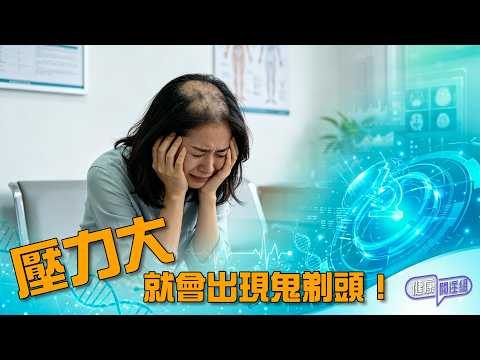 壓力大就會出現鬼剃頭！ ｜ 健康關注組 ｜ EP566  ｜ 斑禿 ｜ 鬼剃頭 ｜ 麥詩敏 ｜敖嘉年 ｜ HOY 77 thumbnail