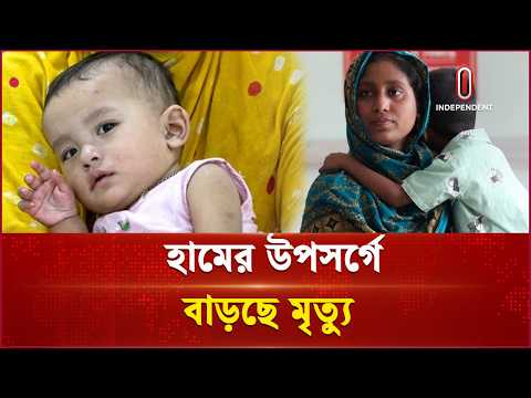 ঈদেও হাসপাতাল খোলা রাখার কঠোর নির্দেশ | Noakhali Measles | Independent TV thumbnail