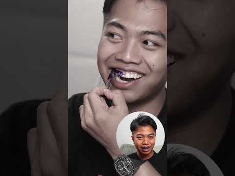 เหมือนโฆษณาจริงๆ LINEE แผ่นแปะฟัน thumbnail