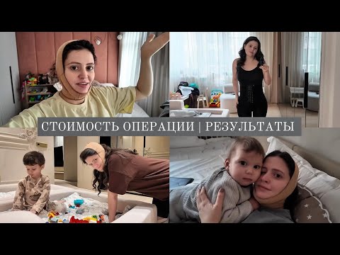VLOG // Стоимость операции // Первые результаты // Ответ на осуждения thumbnail