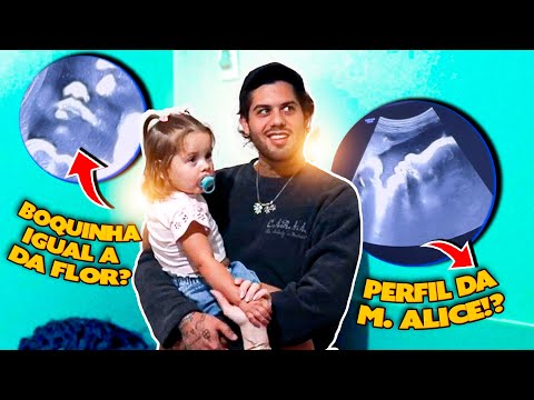 FIZEMOS A ULTIMA ULTRASSOM DO JOSÉ LEONARDO!!! thumbnail