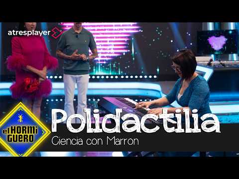 La increíble demostración de una persona con polidactilia - El Hormiguero thumbnail