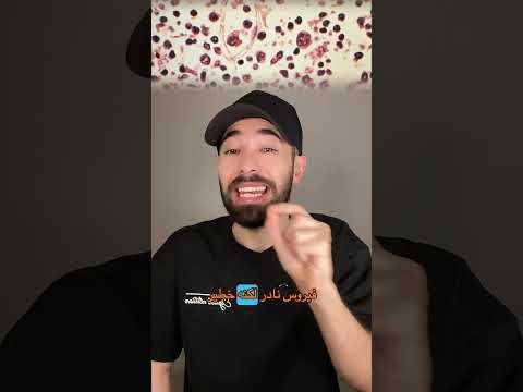 تفشي فيروس هانتا على سفينة وسط الأطلسي… 3 وفيات وحالة استنفار صحي 😳😱 thumbnail