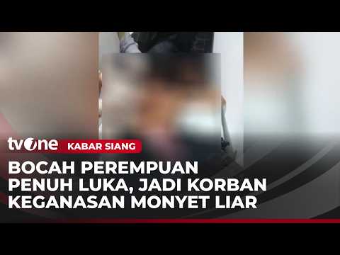 Alami Luka Puluhan Jahitan, Bocah Diserang Monyet Liar | Kabar Siang thumbnail